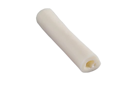 Radius