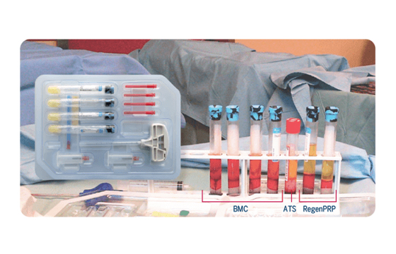 Extracell BMC