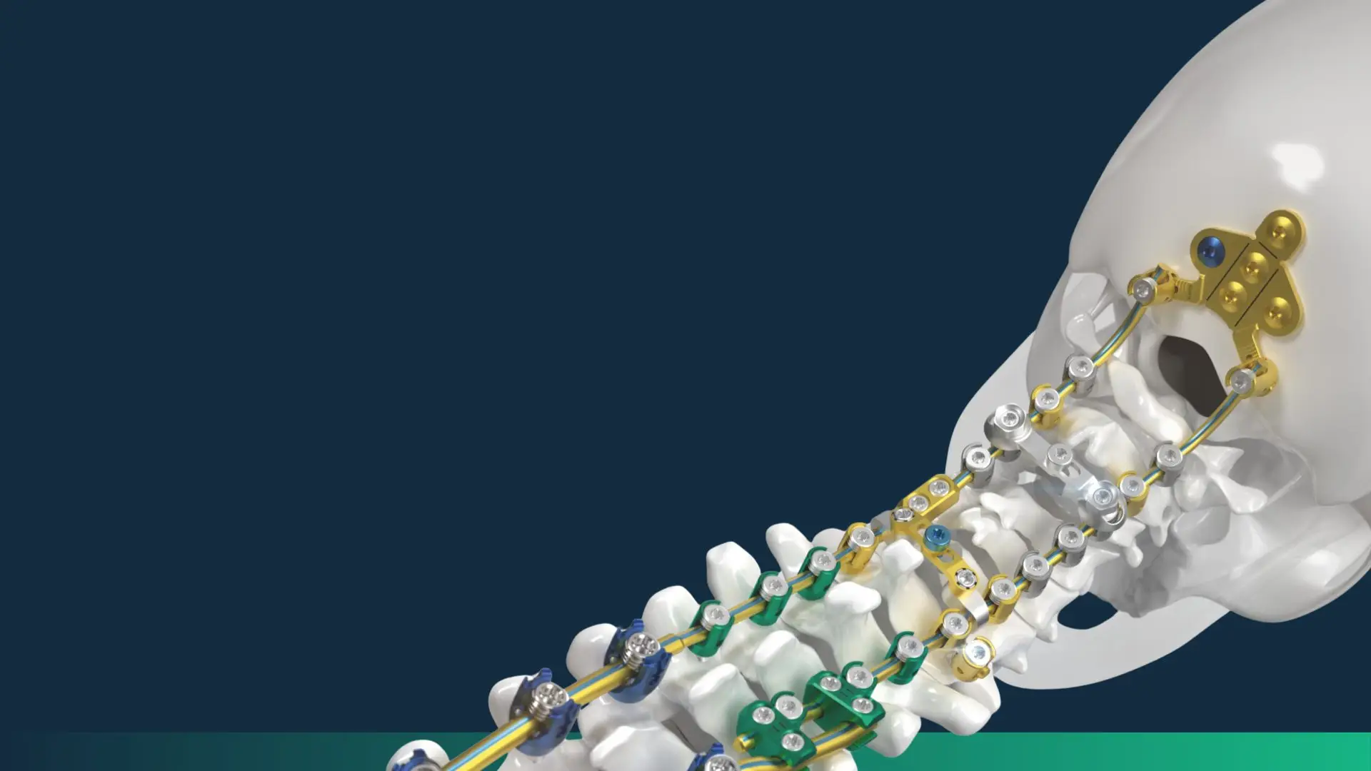 B. Braun and Joint Operations Ltd. are pleased to announce a new distribution partnership for the B. Braun spine portfolio across the UK