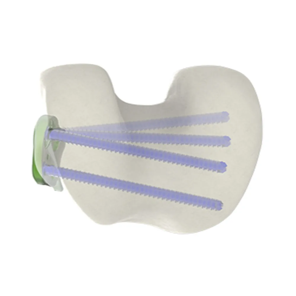DFO Closing & Derotation plate