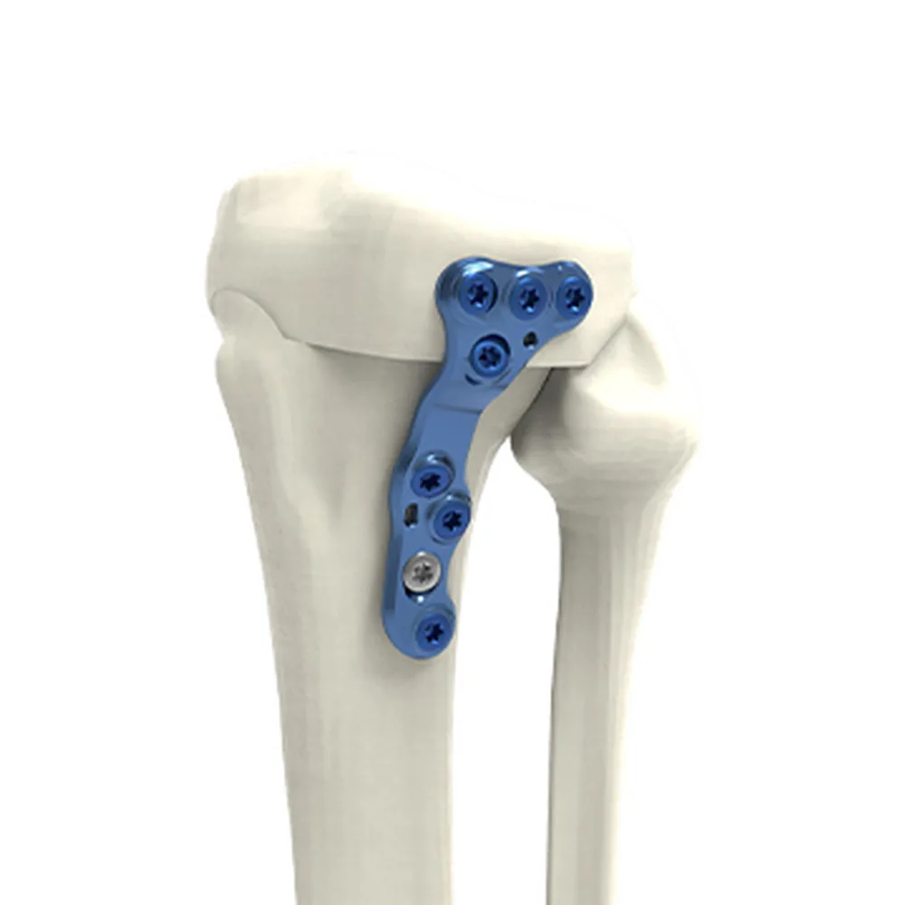 HTO closing lateral plate