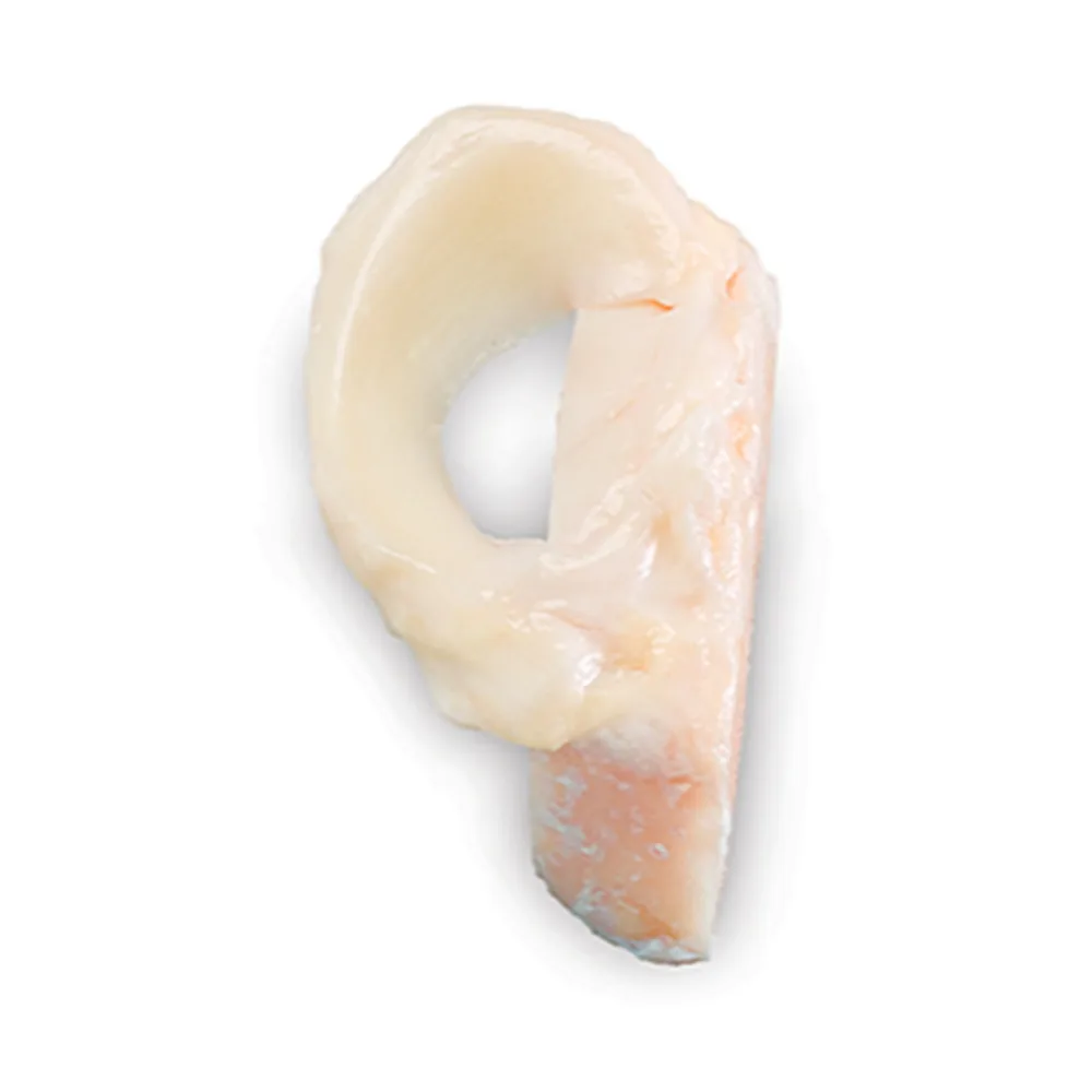 Meniscus