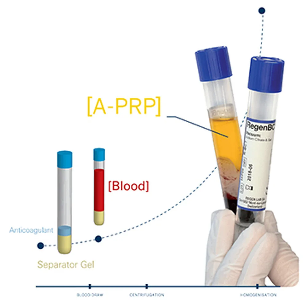 RegenKit A-PRP